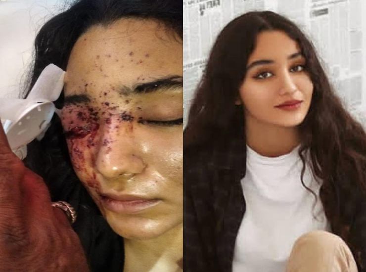 Una ragazza colpita al volto dalle forze di polizia. Le donne sono colpite anche ai genitali, secondo le denunce di alcuni medici iraniani al Guardian 