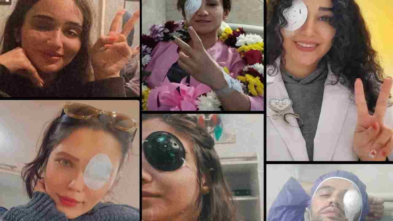 iran spari viso donne polizia