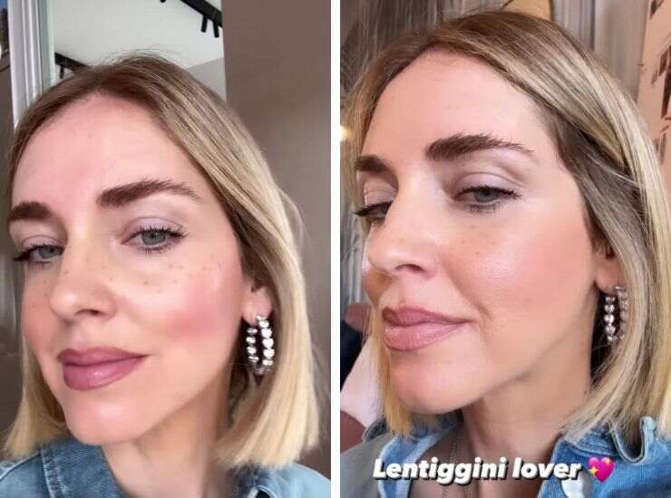 lentiggini finte Chiara Ferragni