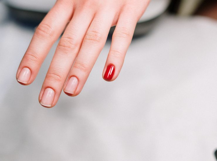 smalto sbeccato rimedi