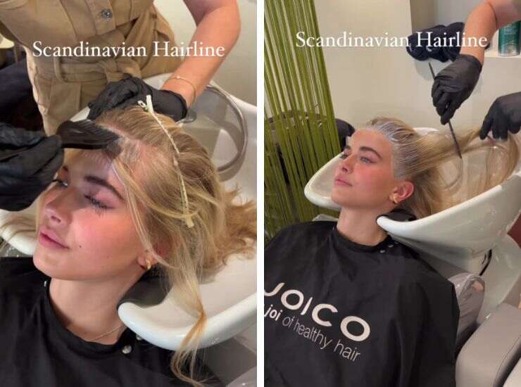 Scandinavian Hairline