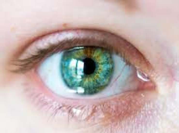 secrezioni oculari